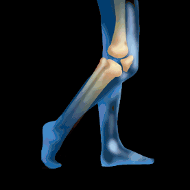 医疗关节炎膝盖疼痛骨骼人体腿蓝色动图gif