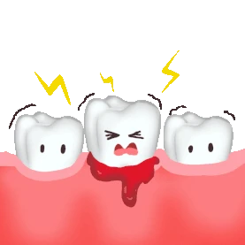 口腔牙齿牙痛牙疼敏感牙流血动图gif