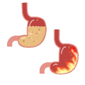 医疗人体器官胃酸胃热蠕动gif图素材