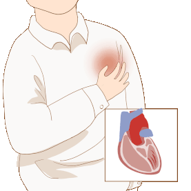 医疗科学体检医学外科人体器官病变效果示意图心脏疼痛心血管疾病gif图素材