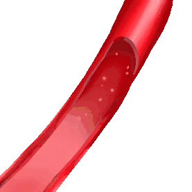 医疗血管堵塞心血管疾病血红蛋白血栓红色gif图素材图片